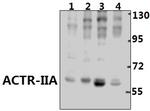 ACVR2A Antibody in Western Blot (WB)