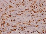 VEGFD Antibody in Immunohistochemistry (Paraffin) (IHC (P))