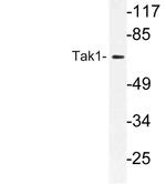 TAK1 Antibody in Western Blot (WB)