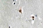 MEF2C Antibody in Immunohistochemistry (Paraffin) (IHC (P))