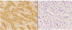 ACAT1 Antibody in Immunohistochemistry (Paraffin) (IHC (P))