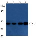 ACAT1 Antibody in Western Blot (WB)