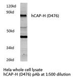 NCAPH Antibody in Western Blot (WB)