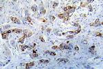 CaMKII alpha Antibody in Immunocytochemistry (ICC/IF)