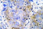 JAK1 Antibody in Immunohistochemistry (Paraffin) (IHC (P))