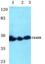 CAR Antibody in Western Blot (WB)