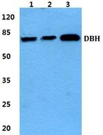 Dopamine beta Hydroxylase Antibody in Western Blot (WB)