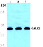 GALK1 Antibody in Western Blot (WB)