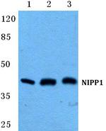 PPP1R8 Antibody in Western Blot (WB)