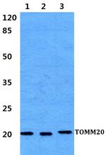 TOMM20 Antibody in Western Blot (WB)