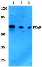 FCAR Antibody in Western Blot (WB)