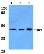 CDK9 Antibody in Western Blot (WB)