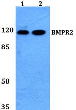 BMPR2 Antibody in Western Blot (WB)