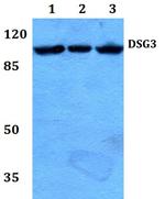 Desmoglein 3 Antibody in Western Blot (WB)