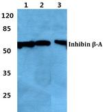 Activin A Antibody in Western Blot (WB)