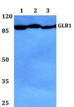 GLB1 Antibody in Western Blot (WB)