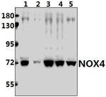NOX4 Antibody in Western Blot (WB)