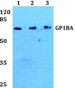 CD42b Antibody in Western Blot (WB)