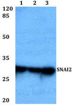 SLUG Antibody in Western Blot (WB)