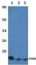 Follicle Stimulating Hormone Antibody in Western Blot (WB)