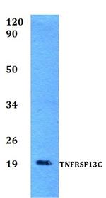 CD268 (BAFF Receptor) Antibody in Western Blot (WB)