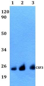 G-CSF Antibody in Western Blot (WB)