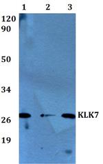 Kallikrein 7 Antibody in Western Blot (WB)