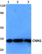 Calponin 1 Antibody in Western Blot (WB)