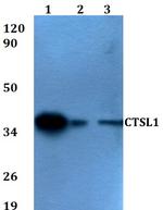 Cathepsin L Antibody in Western Blot (WB)