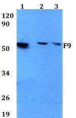 Factor IX Antibody in Western Blot (WB)