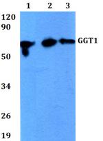 GGT1 Antibody in Western Blot (WB)