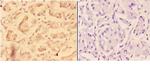 ADAM12 Antibody in Immunohistochemistry (Paraffin) (IHC (P))