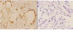 ADAM12 Antibody in Immunohistochemistry (Paraffin) (IHC (P))