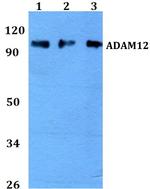 ADAM12 Antibody in Western Blot (WB)