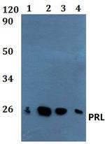 Prolactin Antibody in Western Blot (WB)