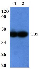 IL1R2 Antibody in Western Blot (WB)