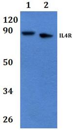 IL4R Antibody in Western Blot (WB)