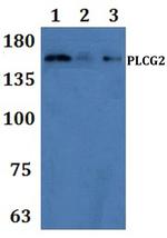 PLCG2 Antibody in Western Blot (WB)