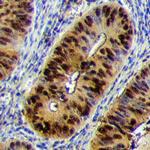 Cdc25A Antibody in Immunohistochemistry (Paraffin) (IHC (P))