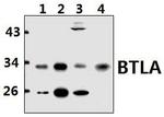 BTLA Antibody in Western Blot (WB)