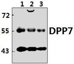 DPP2 Antibody in Western Blot (WB)