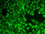 Cathepsin D Antibody in Immunocytochemistry (ICC/IF)