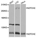 NOTCH2 Antibody in Western Blot (WB)