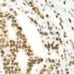 NFkB p52 Antibody in Immunohistochemistry (Paraffin) (IHC (P))