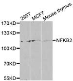 NFkB p52 Antibody in Western Blot (WB)