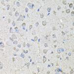 CD97 Antibody in Immunohistochemistry (Paraffin) (IHC (P))