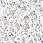 Carboxypeptidase A1 Antibody in Immunohistochemistry (Paraffin) (IHC (P))