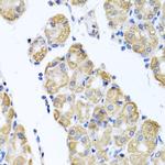 Glutaminase Antibody in Immunohistochemistry (Paraffin) (IHC (P))