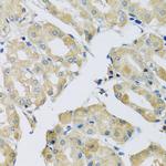 ABCF2 Antibody in Immunohistochemistry (Paraffin) (IHC (P))