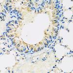 ABCF2 Antibody in Immunohistochemistry (Paraffin) (IHC (P))